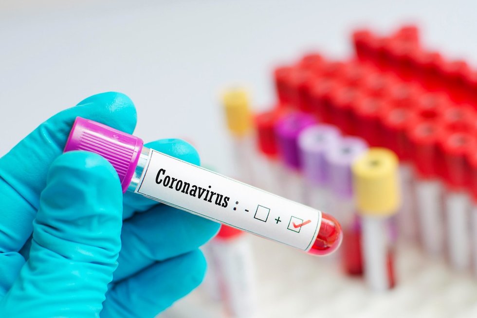 Koronavirusas (nuotr. 123rf.com)