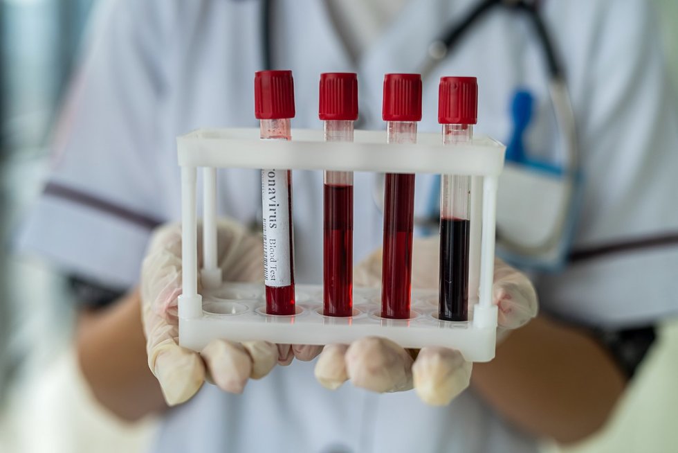 kraujo tyrimai (nuotr. 123rf) kraujo tyrimai (nuotr. 123rf)