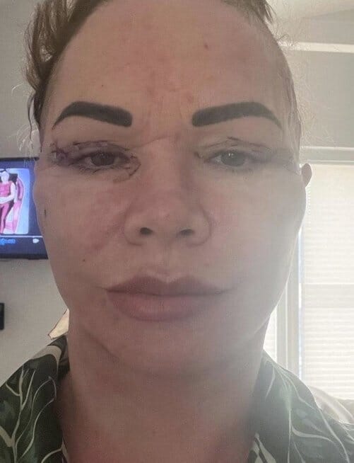 Angela Paterson po operacijų (nuotr. facebook.com)